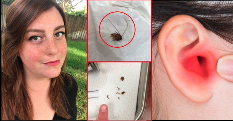 Doctors Pulled a Cockroach Out of Her Ear, but Her Nightmare Continued Nine Days Later